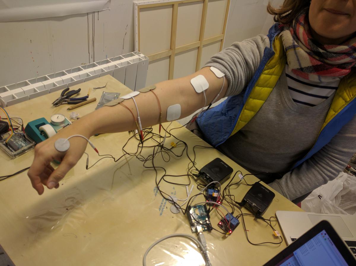 Device with 8 electrodes (EMG) for more precise control of Cristina’s arm.
